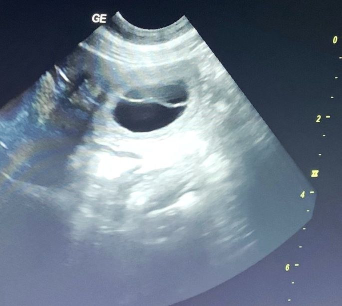 du Mas Roc Maria - gestation confirmée pour PEAUDANE